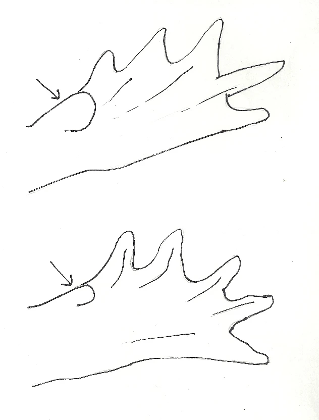 Todo